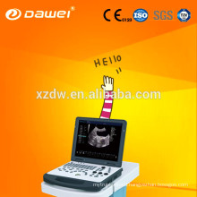 CE & ISO 3D color doppler ultrasound as well as sonoscape ultrasound for Cardiac Vessel Liver Kidney Pediatrics